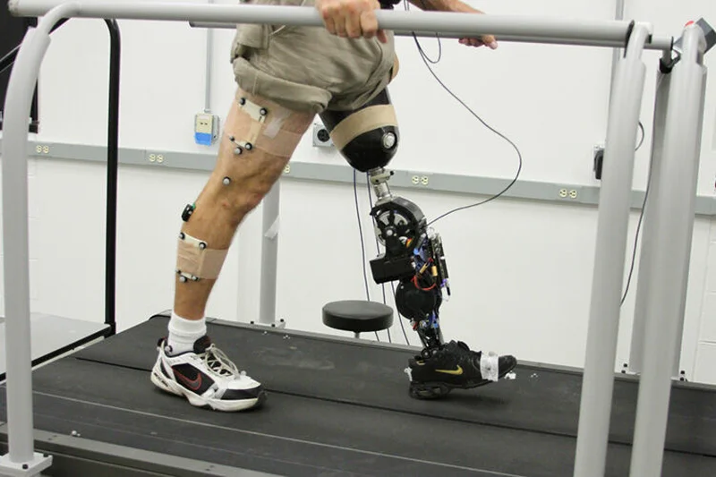 #GoodNews: Alumnus’ Design of Powered Prosthetic Leg Aims To Give Amputees More Control